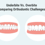 Overbite Vs. Underbite: Comparing Orthodontic Challenges