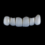 Long-Term Benefits of Restorative Dentistry